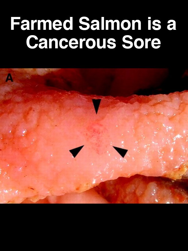 #26 Farmed Salmon is a Cancerous Sore