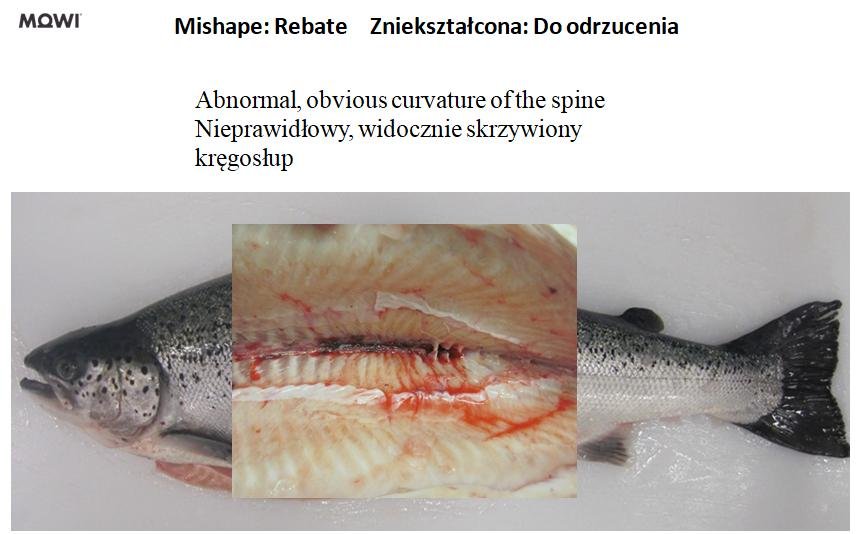 Photo #5 mishape curvature of spine Photo #5 mishape curvature of spine